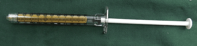 Fat injection under eyes