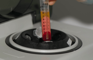 fat-grafting-centrifuge