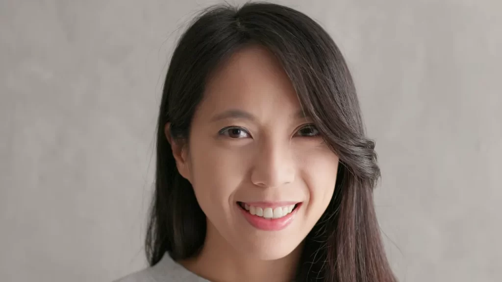 before and after asian eyelid blepharoplasty