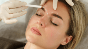 Botox for Eyelid Lift