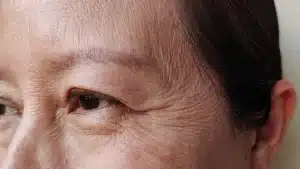 asian eyelids