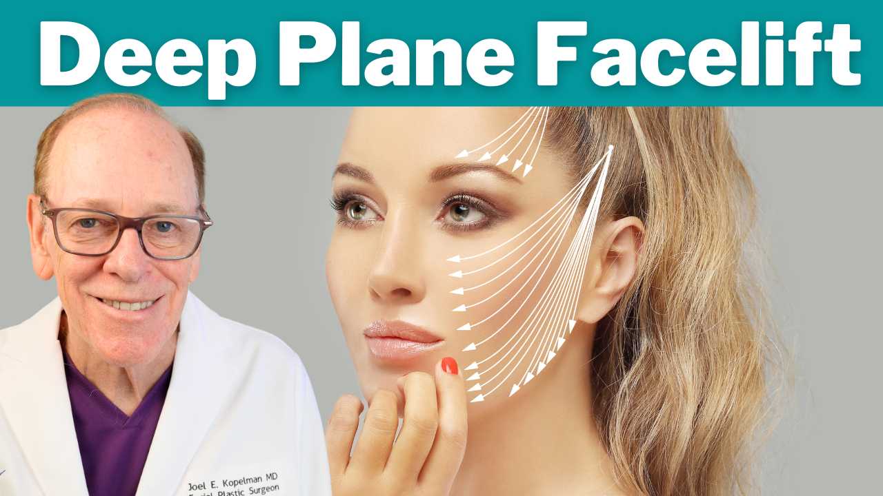 reason for a deep plane facelift