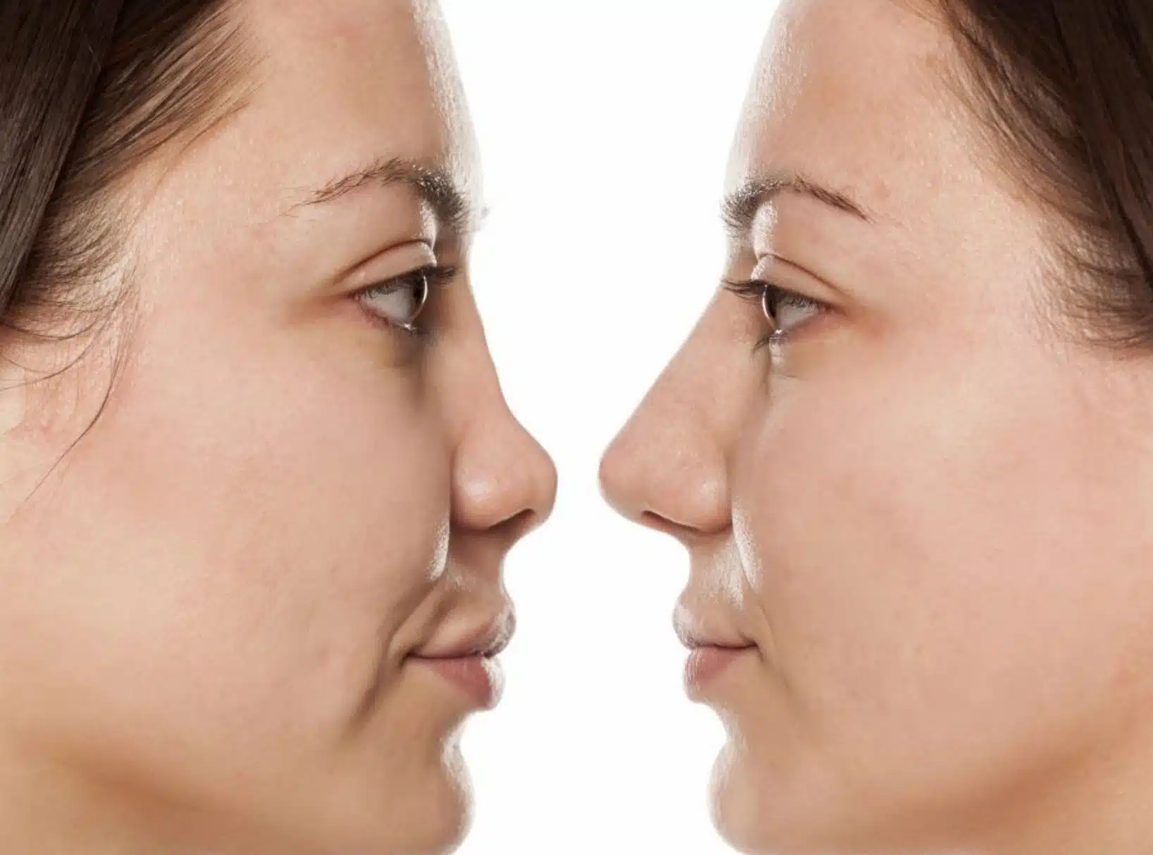 botched-surgery-before-and-after