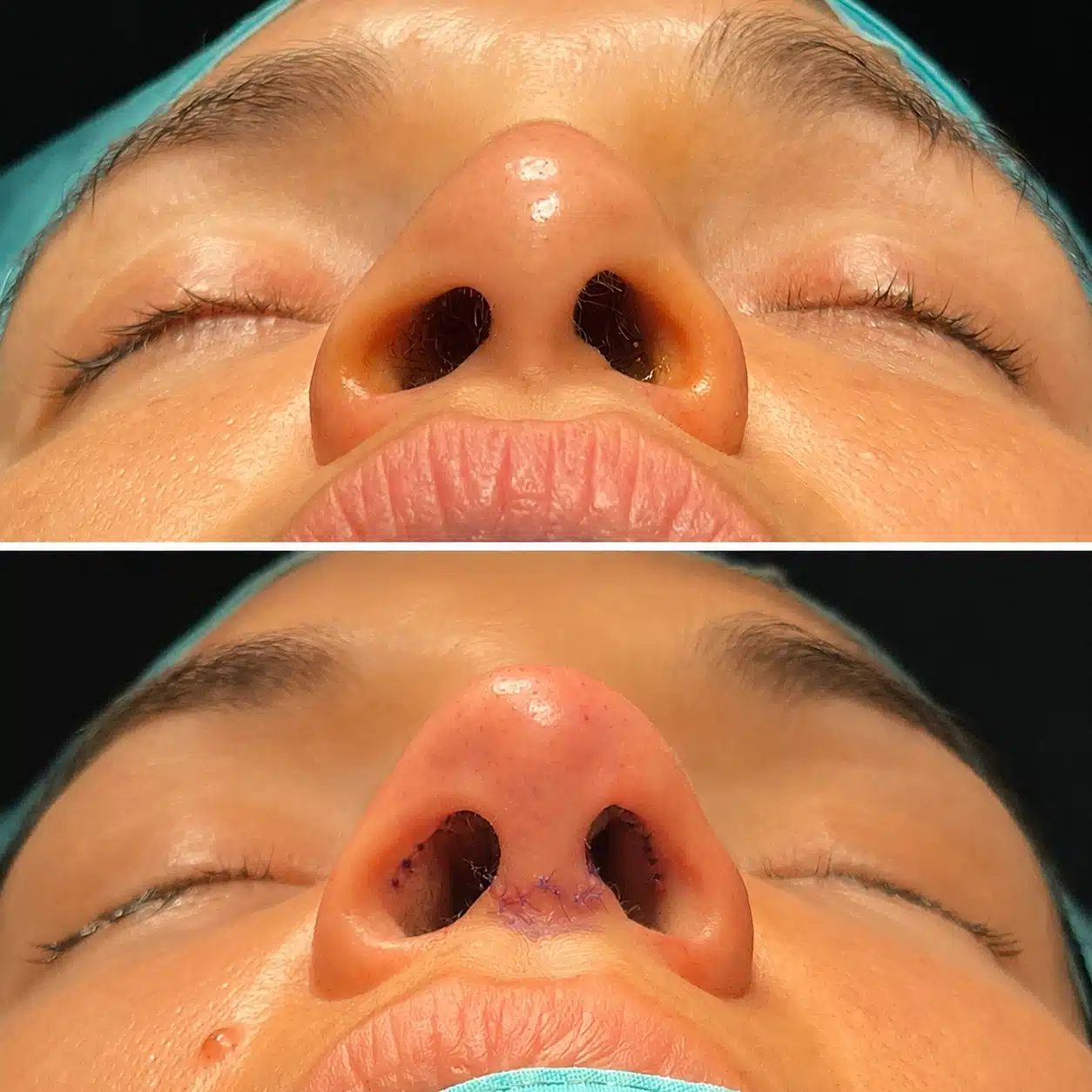 botched-surgery-before-and-after