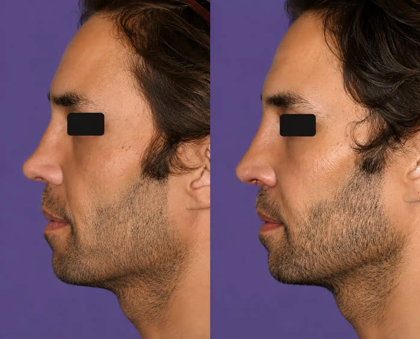 botched-surgery-before-and-after