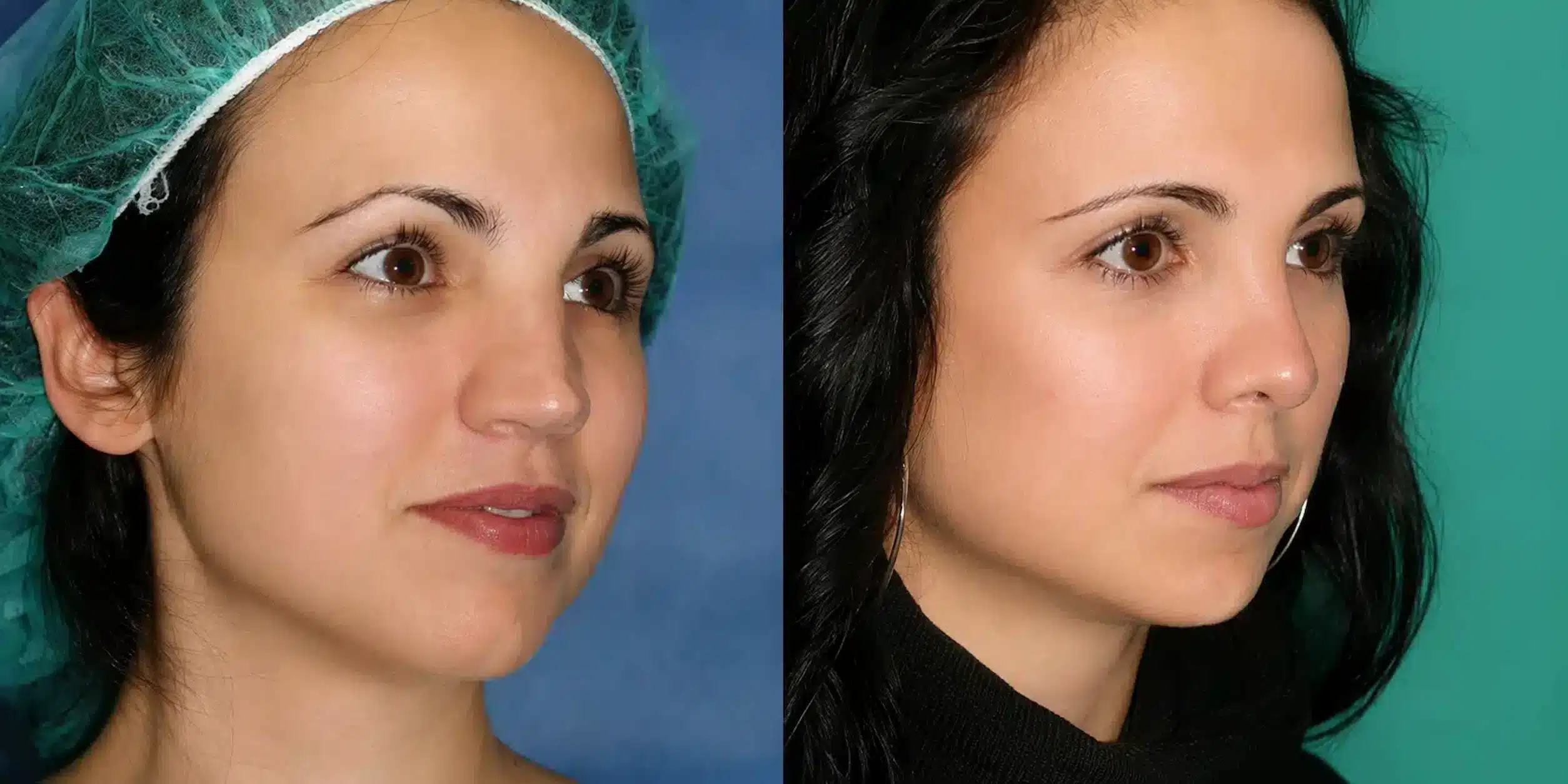 botched-surgery-before-and-after